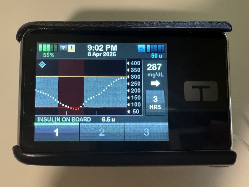 Tslim X2 insulin pump